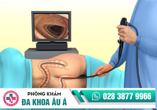 Nội soi hậu môn