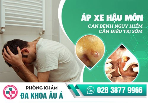 Nguyên nhân nào gây ra áp xe hậu môn?