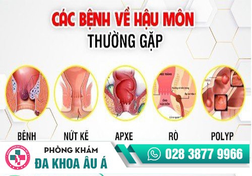 Các bệnh hậu môn