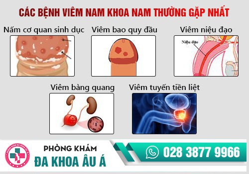 bệnh nam khoa thường gặp