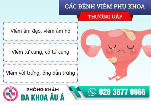 bệnh phụ khoa thường gặp