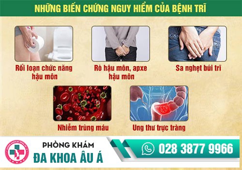 Bệnh trĩ hỗn hợp có nguy hiểm không?