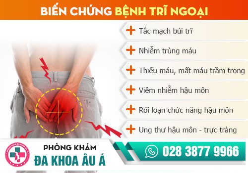 Bệnh trĩ ngoại có nguy hiểm không?