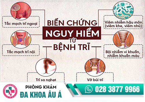  Vậy tắc mạch trĩ có nguy hiểm không?