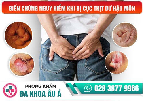 Dấu hiệu bệnh chàm ở hậu môn