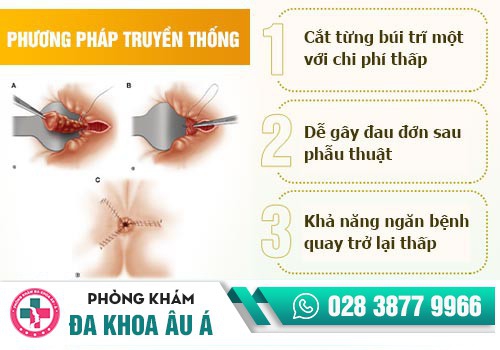 PHƯƠNG PHÁP ĐIỀU TRỊ BỆNH TRĨ HIỆU QUẢ HIỆN NAY