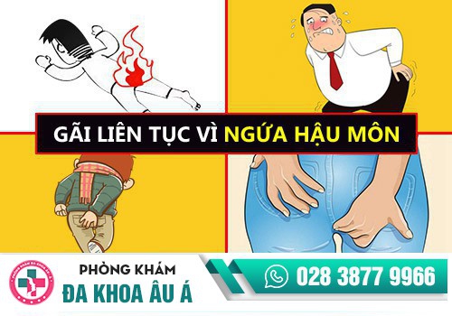 Tại sao bị ngứa hậu môn?