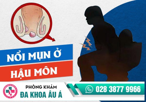 NỔI MỤN NHỌT HẬU MÔN LÀ BỆNH GÌ?