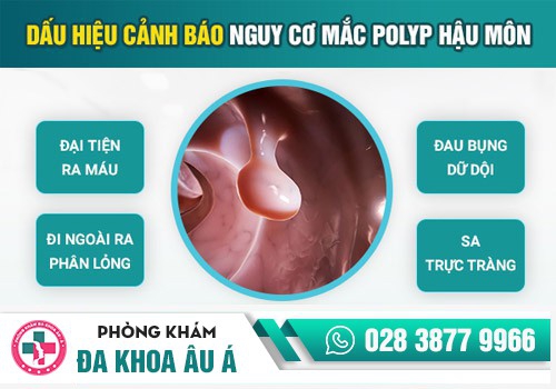 Polyp hậu môn có nguy hiểm không?
