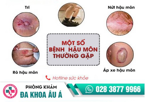  MỘT SỐ BỆNH HẬU MÔN TRỰC TRÀNG THƯỜNG GẶP