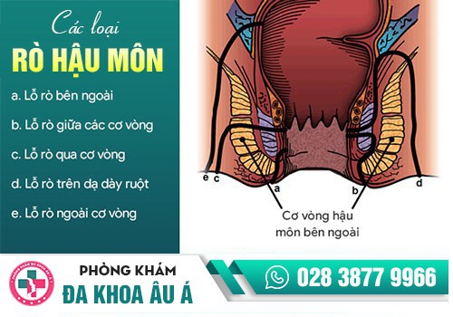 BỆNH MẠCH LƯƠN LÀ GÌ?