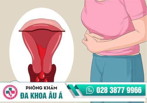 Bị đau rát hậu môn khi đi vệ sinh có nguy hiểm không?
