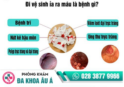 đi cầu ra máu tươi