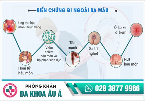 ung thư thực tràng