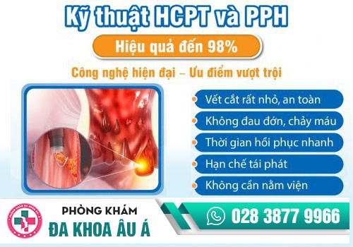 Điều trị bệnh trĩ hiệu quả bằng PPH và HCPT