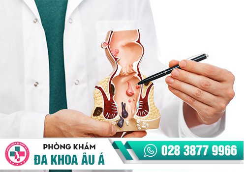 Lý do nên khám trĩ tại phòng khám uy tín