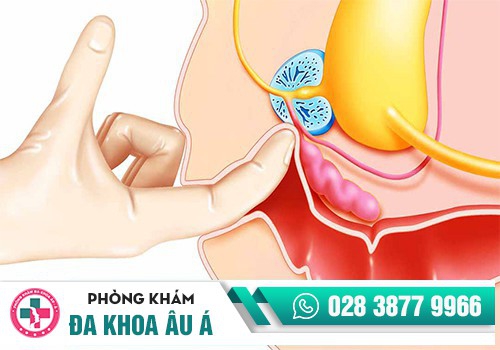 Phương pháp kiểm tra hậu môn bằng mắt, tay: 
