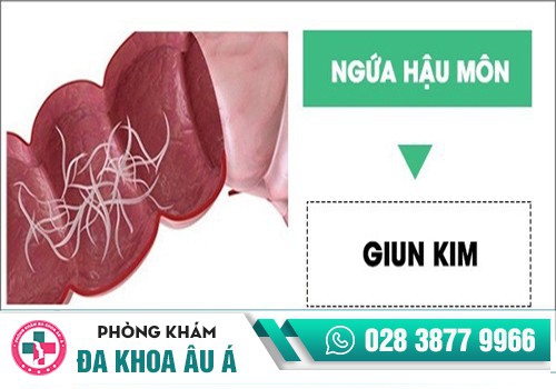 Ngứa hậu môn dấu hiệu cảnh báo bệnh lý ở hậu môn – trực tràng