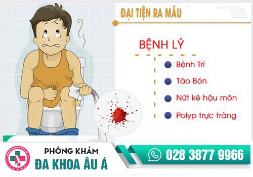 Phương pháp chẩn đoán nguyên nhân gây đi cầu ra máu