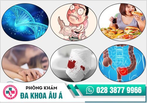 Những nguyên nhân gây Polyp hậu môn