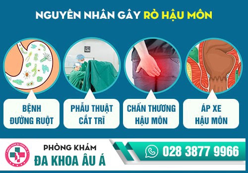 NGUYÊN NHÂN GÂY BỆNH MẠCH LƯƠN