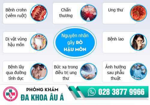 Bệnh rò hậu môn là gì?