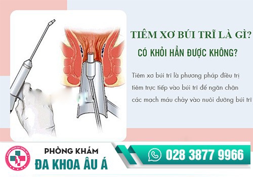  thuốc tiêm teo trĩ, tiêm xơ trĩ