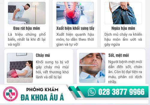 Dấu hiệu nhận biết áp xe hậu môn
