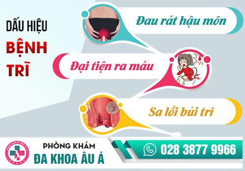 Các dấu hiệu bệnh trĩ 