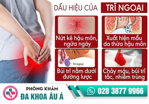 LÒI CON TRÊ LÀ GÌ?