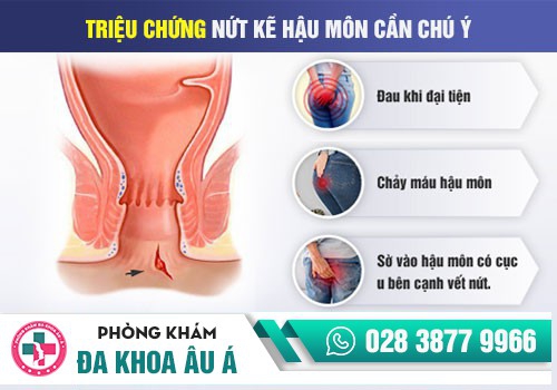NỨT KẼ HẬU MÔN LÀ GÌ 